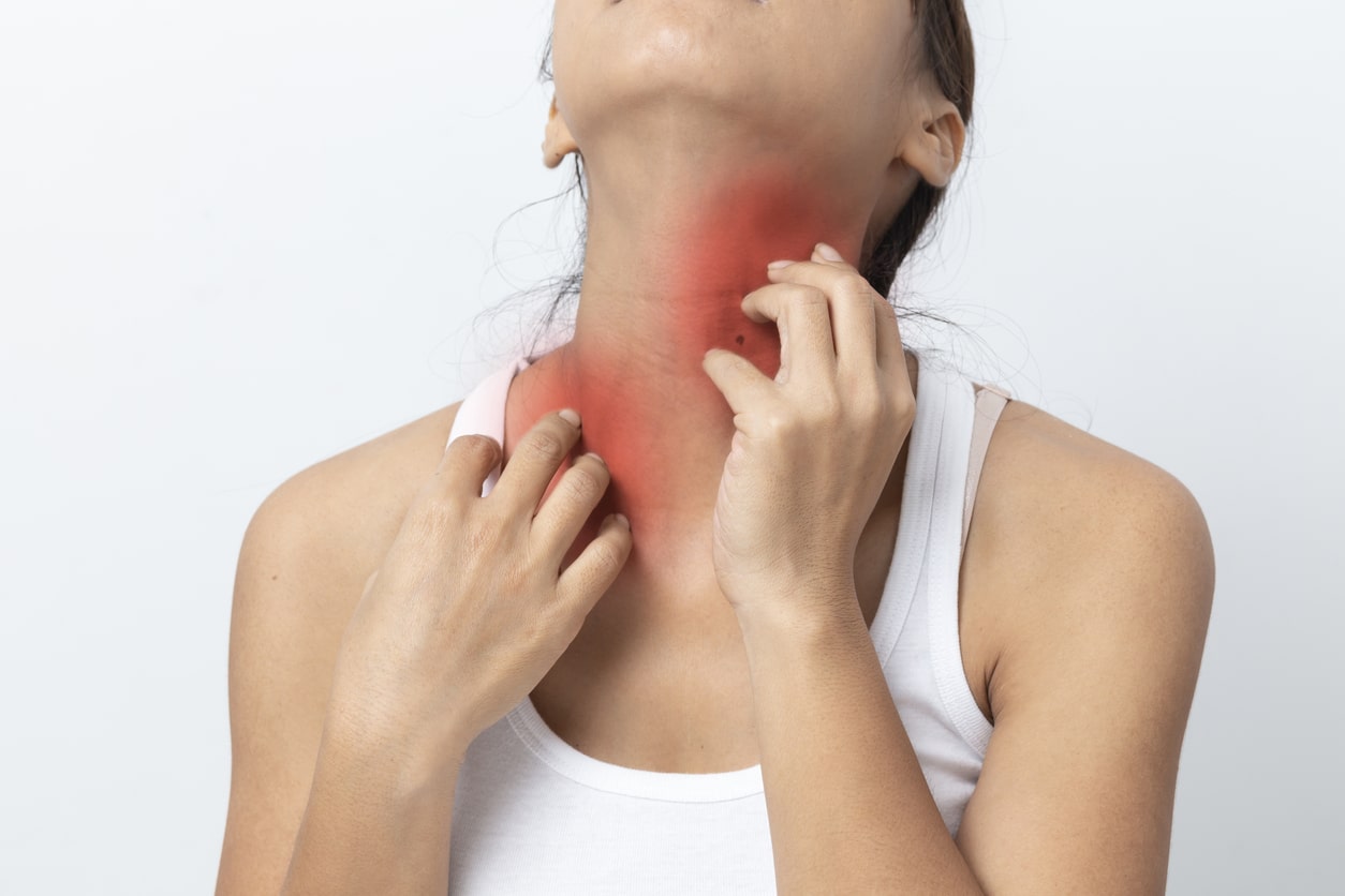 Woman itchy skin scratching her neck Isolated
