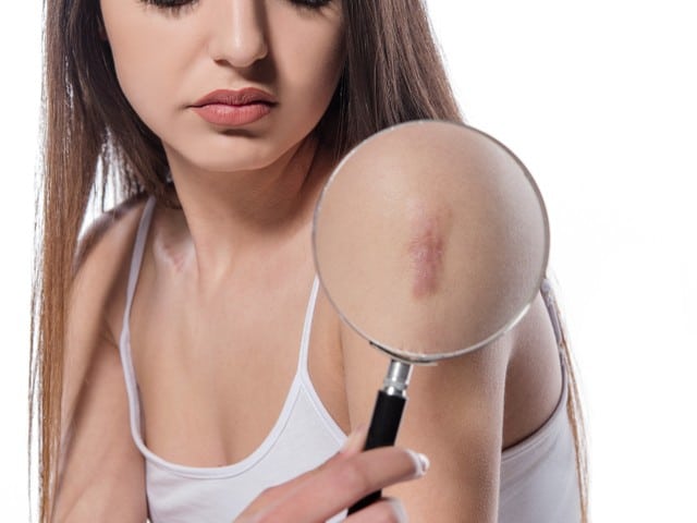 woman holding magnifying glass and showing surgery scar.