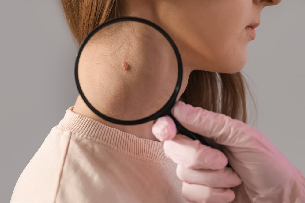 Dermatologist,Examining,Young,Woman's,Mole,With,Magnifier,On,Grey,Background,