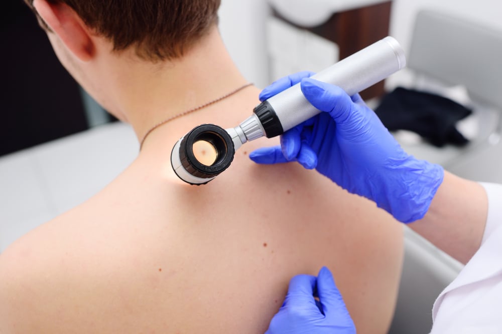A doctor examining moles on a patient’s back to look for early signs of skin cancer.