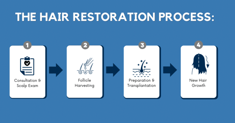 Plantation NeoGraft® Hair Restoration